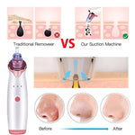 Multifunctional Beauty Pore Vacuum 4 in 1 - Trendy Planet
