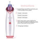 Multifunctional Beauty Pore Vacuum 4 in 1 - Trendy Planet